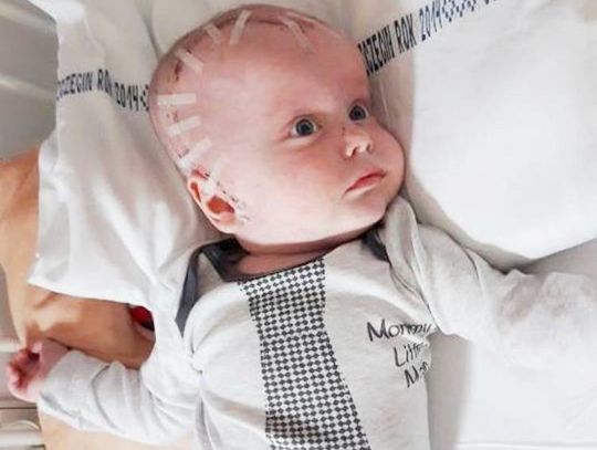 Kubuś stracił tatusia, teraz walczy o swoje życie...